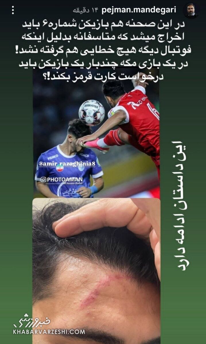 استوری ماندگاری 