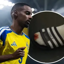 زخم‌های نبرد بر تن الکساندر! (عکس)