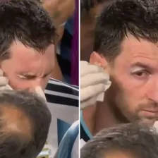 مسی با چشم خونین به بازی ادامه داد! (عکس)