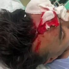 حادثه تلخ در ورزشگاه یاسوج: جمجمه شکست!