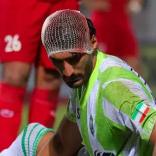 سر شکسته و صورت خونی، عکس ترسناک از لیگ ایران!